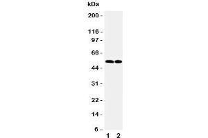 Western blot testing of CCR3 antibody and Lane 1:  K562;  2: Raji cell lysate. (CCR3 Antikörper  (N-Term))