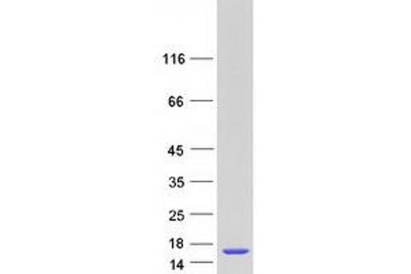 LSM5 Protein (Transcript Variant 1) (Myc-DYKDDDDK Tag)