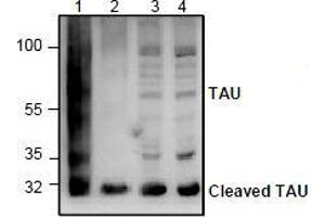 Western blot analysis of TAU in rat kidney tissue lysate (Lane 1), 3T3 cell lysate (Lane 2), and Jurkat cell lysate (Lane 3 & 4). (MAPT Antikörper)