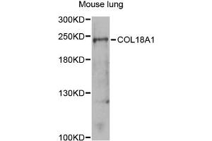 Western blot analysis of extracts of mouse lung, using COL18A1 antibody (ABIN5970861) at 1/1000 dilution. (COL18A1 Antikörper)