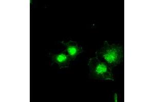 Anti-BCL2L1 mouse monoclonal antibody (ABIN2452380) immunofluorescent staining of COS7 cells transiently transfected by pCMV6-ENTRY BCL2L1 (RC201314). (BCL2L1 Antikörper  (AA 1-212))