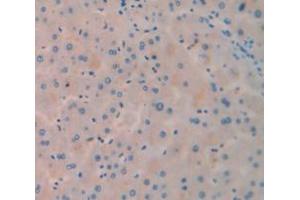 IHC-P analysis of Human Tissue, with DAB staining. (PCK1 Antikörper  (AA 311-558))