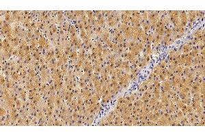 Detection of GHR in Human Liver Tissue using Polyclonal Antibody to Growth Hormone Receptor (GHR) (Growth Hormone Receptor Antikörper  (AA 315-574))