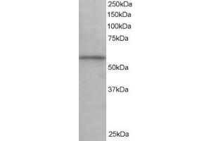 Western Blotting (WB) image for anti-Karyopherin alpha 3 (Importin alpha 4) (KPNA3) antibody (ABIN5921579) (KPNA3 Antikörper)