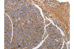 Immunohistochemistry (IHC) image for anti-CD151 (CD151) antibody (ABIN2421447) (CD151 Antikörper)