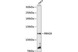 Western blot analysis of extracts of HeLa cells, using RBM26 antibody  at 1:3000 dilution. (RBM26 Antikörper  (AA 65-140))