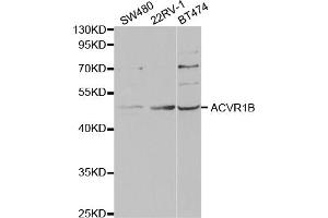 Western blot analysis of extracts of various cell lines, using ACVR1B antibody. (Activin A Receptor Type IB/ALK-4 Antikörper)