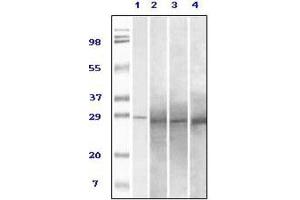 Western Blotting (WB) image for anti-RAB25, Member RAS Oncogene Family (RAB25) antibody (ABIN1844336) (RAB25 Antikörper)