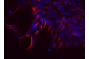 Immunocytochemistry (ICC) image for anti-Nestin (NES) antibody (ABIN1742563) (Nestin Antikörper)