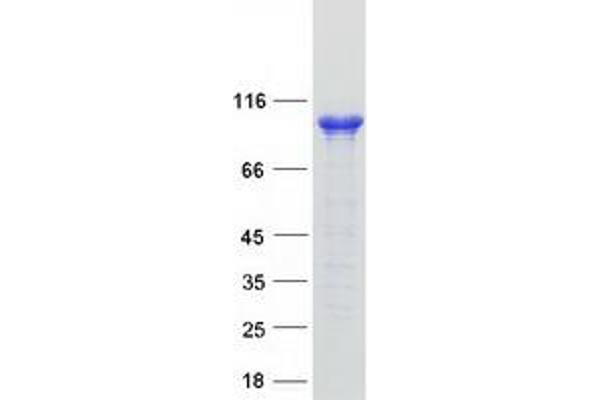 AP2B1 Protein (Transcript Variant 1) (Myc-DYKDDDDK Tag)