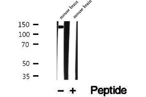 Western blot analysis of extracts of mouse brain tissue, using TRAPPC9 antibody. (TRAPPC9 Antikörper  (Internal Region))