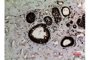 Immunohistochemistry (IHC) analysis of paraffin-embedded Human Breast Cancer, antibody was diluted at 1:100. (Histone 3 Antikörper  (2meLys10))
