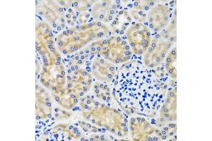 Immunohistochemistry of paraffin-embedded mouse kidney using ANTXR2 antibody at dilution of 1:100 (x40 lens). (ANTXR2 Antikörper)