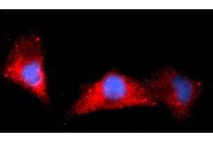 Immunofluorescence (IF) image for anti-Aldehyde Dehydrogenase 1 Family, Member A1 (ALDH1A1) (AA 1-501) antibody (APC) (ABIN5568626) (ALDH1A1 Antikörper  (AA 1-501) (APC))