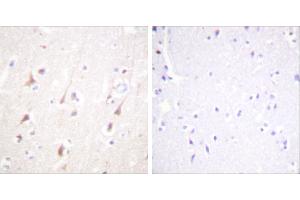 Peptide - +Immunohistochemistry analysis of paraffin-embedded human brain tissue using IRS-1 antibody. (IRS1 Antikörper)