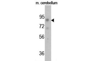 Western Blotting (WB) image for anti-FGFR (pTyr766) antibody (ABIN3001757) (FGFR (pTyr766) Antikörper)