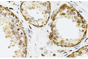 Immunohistochemistry of paraffin-embedded Human prostate using POP4 Polyclonal Antibody at dilution of 1:100 (40x lens). (RPP29 Antikörper)
