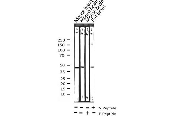 CEBPA Antikörper  (pSer21)