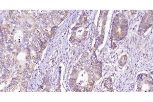 Immunohistochemistry (Paraffin-embedded Sections) (IHC (p)) image for anti-CD28 (CD28) (AA 1-120) antibody (ABIN674604)