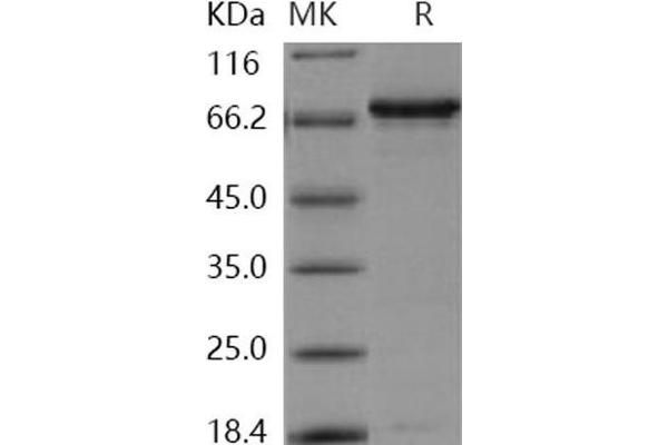 Insulin Receptor Protein (INSR) (GST tag,His tag)