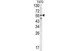 Western Blotting (WB) image for anti-Fibrinogen beta Chain (FGB) antibody (ABIN3002657) (Fibrinogen beta Chain Antikörper)