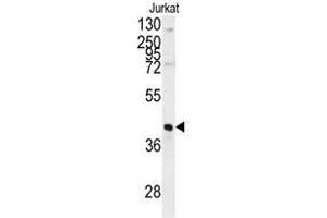 Image no. 1 for anti-Fructose-1,6-Bisphosphatase 1 (FBP1) (N-Term) antibody (ABIN452993) (FBP1 Antikörper  (N-Term))