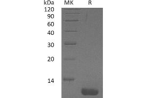 Greater than 95 % as determined by reducing SDS-PAGE. (CCL1 Protein)