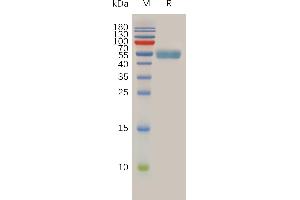 Human Protein, mFc Tag on SDS-PAGE under reducing condition. (RNF43 Protein (AA 43-197) (mFc Tag))