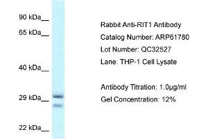 Western Blotting (WB) image for anti-Ras-Like Without CAAX 1 (RIT1) (Middle Region) antibody (ABIN786493) (RIT1 Antikörper  (Middle Region))