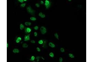 Anti-TP53 mouse monoclonal antibody (ABIN2454638) immunofluorescent staining of COS7 cells transiently transfected by pCMV6-ENTRY TP53 (RC200003). (p53 Antikörper)