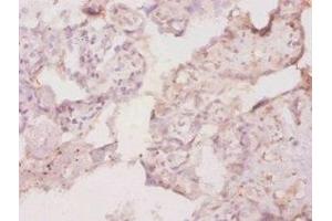 Immunohistochemistry of paraffin-embedded human placenta tissue using ABIN7177414 at dilution of 1:20 (M-CSF/CSF1 Antikörper  (AA 33-262))