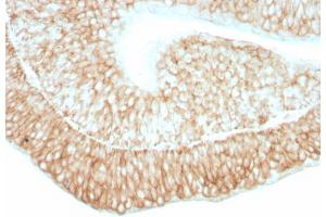 Formalin-fixed, paraffin-embedded human bladder stained with CD59 Mouse Monoclonal Antibody (193-27). (CD59 Antikörper)