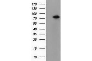 Western Blotting (WB) image for anti-Pseudouridylate Synthase 7 Homolog (PUS7) antibody (ABIN1500516) (PUS7 Antikörper)