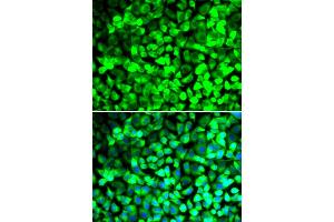 Immunofluorescence analysis of U2OS cells using EIF5 antibody. (EIF5 Antikörper)