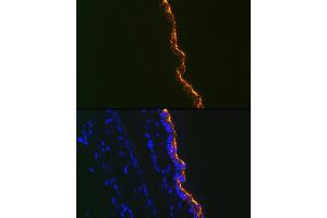 Immunofluorescence analysis of Mouse tail and ear using Cytokeratin 10 Rabbit mAb (ABIN1679404, ABIN3019133, ABIN3019134 and ABIN7101721) at dilution of 1:100 (40x lens). (Keratin 10 Antikörper)