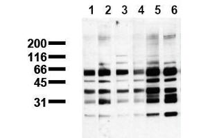 Western Blotting (WB) image for anti-Phosphoserine (phosphorylated) antibody (ABIN126865) (Phosphoserine Antikörper  (phosphorylated))