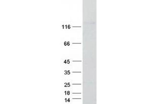 SYNPO2L Protein (Transcript Variant 1) (Myc-DYKDDDDK Tag)