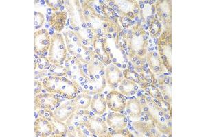 Immunohistochemistry of paraffin-embedded rat kidney using SIRT3 antibody (ABIN5974409) at dilution of 1/100 (40x lens). (SIRT3 Antikörper)