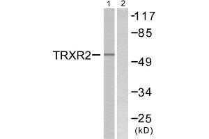 Western blot analysis of extracts from HT29 cells, using TRXR2 antibody. (TXNRD2 Antikörper  (C-Term))