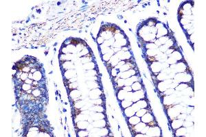 Immunohistochemistry of paraffin-embedded human colon using PBR/TSPORabbit mAb (ABIN1679051, ABIN3019258, ABIN3019259 and ABIN7101738) at dilution of 1:100 (40x lens). (TSPO Antikörper)