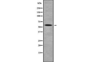 Western blot analysis of MOT9 using COLO205 whole cell lysates (SLC16A9 Antikörper  (Internal Region))