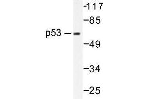 Western blot (WB) analysis of p53 antibody in extracts from HT-29 cells. (p53 Antikörper)