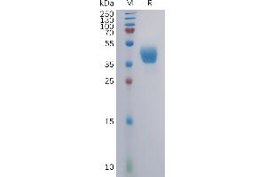 Human Protein, mFc Tag on SDS-PAGE under reducing condition. (CCR2 Protein (AA 1-42) (mFc Tag))