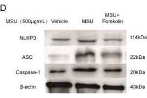 Western Blotting (WB) image for anti-Steroid Sulfatase (STS) antibody (ABIN2170333)