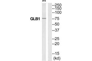 Western Blotting (WB) image for anti-Galactosidase, beta 1 (GLB1) (Internal Region) antibody (ABIN1850915) (GLB1 Antikörper  (Internal Region))