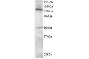 Image no. 1 for anti-Helicase-Like Transcription Factor (HLTF) (C-Term) antibody (ABIN374218) (HLTF Antikörper  (C-Term))