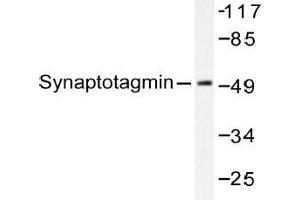 Western blot (WB) analysis of Synaptotagmin antibody in extracts from 293 cells Forskolin 40nM 30' or 293 cells Sorbitol 0. (SYT1 Antikörper)