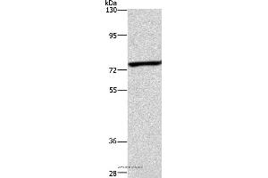 Western blot analysis of Mouse heart tissue, using ABCB8 Polyclonal Antibody at dilution of 1:600 (ABCB8 Antikörper)