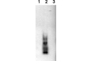 Western Blotting (WB) image for anti-Amyloid beta (Abeta) (AA 1-42), (C-Term), (N-Term) antibody (ABIN126725) (beta Amyloid Antikörper  (C-Term, N-Term))