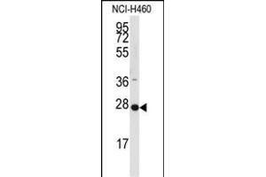 Western blot analysis of anti-C Antibody (C-term) 799b in NCI- cell line lysates (35 μg/lane). (PPAP2C Antikörper  (C-Term))